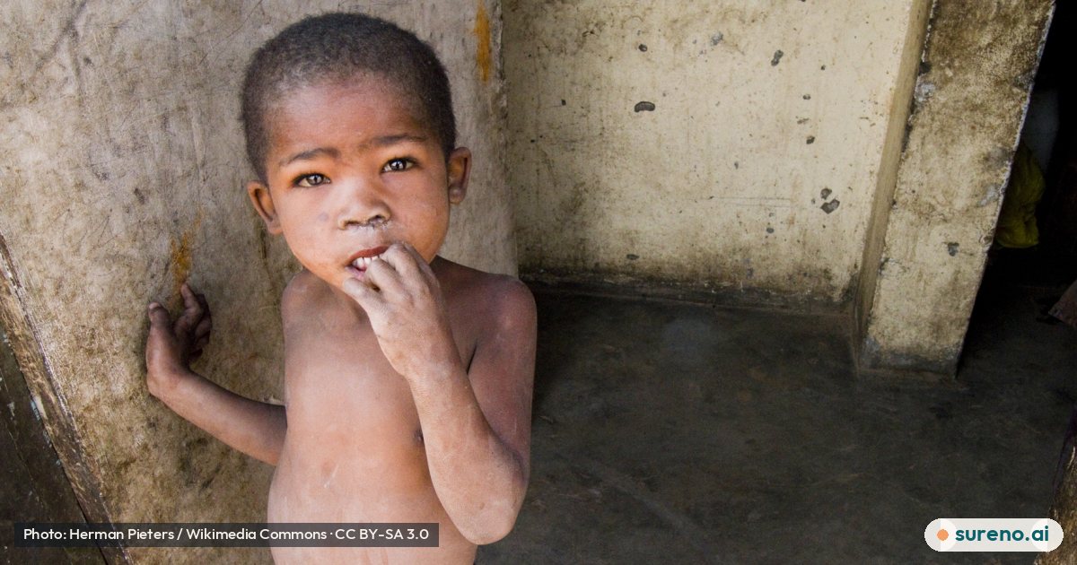 Poverty in Calitzdorp, Western Cape, South Africa.jpg